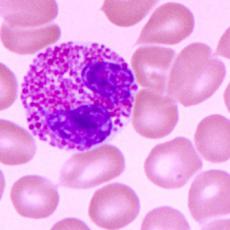 人急性单核细胞白血病细胞（白介素21基因修饰）；THP-1/IL21